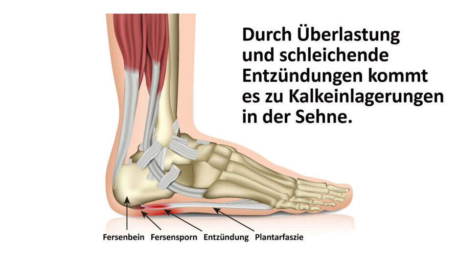Die Abbildung zeigt die Anatomie der Füße.