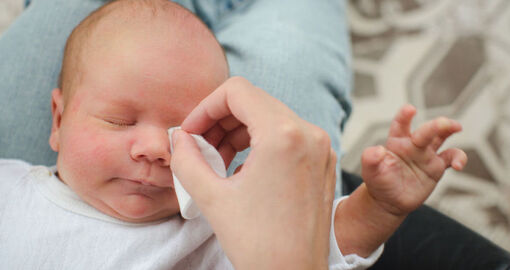 Ein Säugling liegt mit geschlossenen Augen auf dem Schoß eines Elternteils. Das Elternteil säubert das Auge des Babys.